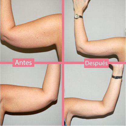 GlowLift™ Pro - Lleva El Spa a Casa Brillo Eterno™